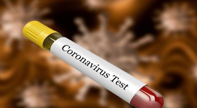 NUST develops testing kits for detecting coronavirus