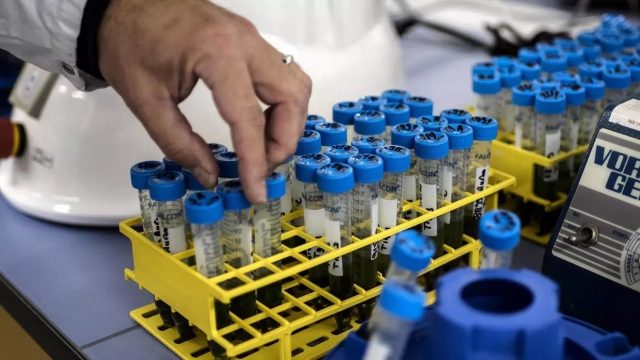 PAKISTAN begins clinical trials of coronavirus blood plasma treatment