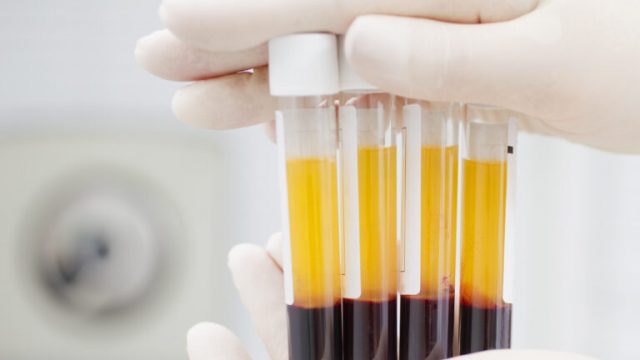 PAKISTAN begins clinical trials of coronavirus blood plasma treatment