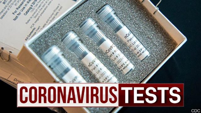 Coronavirus+Test+Kit+MGN